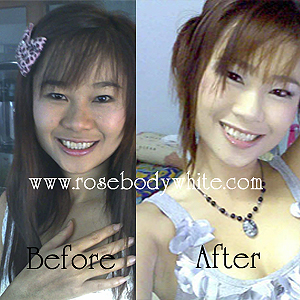 www.rosebodywhtie.com อยากผิวขาว,อยากตัวขาว,อยากหน้าขาวใส,อยากขาวถาวร,เรา รับทำผิวขาวถาวร,ทำผิวขาวถาวร,ผิวขาวถาวร,ได้ รูปที่ 1