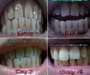 รูปย่อ แผ่นฟอกฟันขาว Crest Whitestrips Supreme และ ยาสีฟัน Crest 3D  อยากฟันขาว ยิ้มสวย ราคาถูก ประหยัดเชิญทางนี้ค่ะ  รูปที่6
