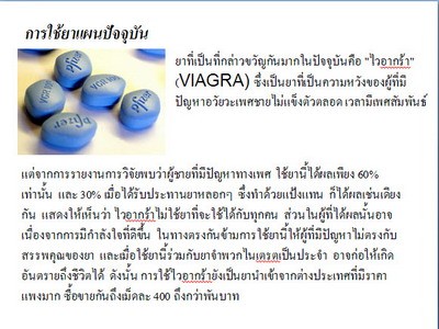 อย่าปล่อยให้ปัญหาเพศสัมพันธ์..ทำลายชีวิตคู่ของคุณ รูปที่ 5