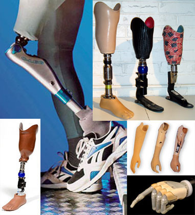 ขาเทียม แขนเทียม รับทำถึงที่โดยหมอช่างประสบการณ์ตรง มีประกันสังคมเบิกได้ รูปที่ 1