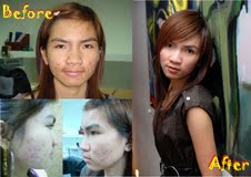 จำหน่ายสบู่กาลอส สโกเรีย 120 กรัม รูปที่ 4