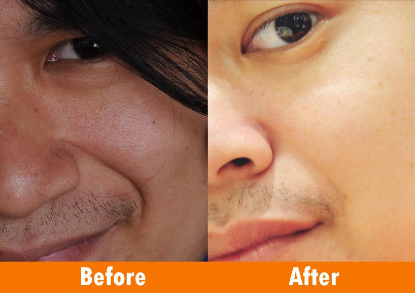 สารสกัดจากเมล็ดองุ่น Grape Seed Oil  รูปที่ 5