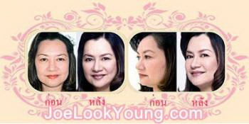 Z-Brease ซีเบรสส์ สุดยอดผลิตภัณฑ์เสริมอาหาร เพื่ออกชู กระชับ ลดการปวดประจำเดือน ชะลอความแก่ เพิ่มความมั่นใจสำหรับสตรี  รูปที่ 4