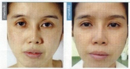 ชุด ageLOC Transformation ความเปลี่ยนแปลงภายใน 7 วัน รูปที่ 1