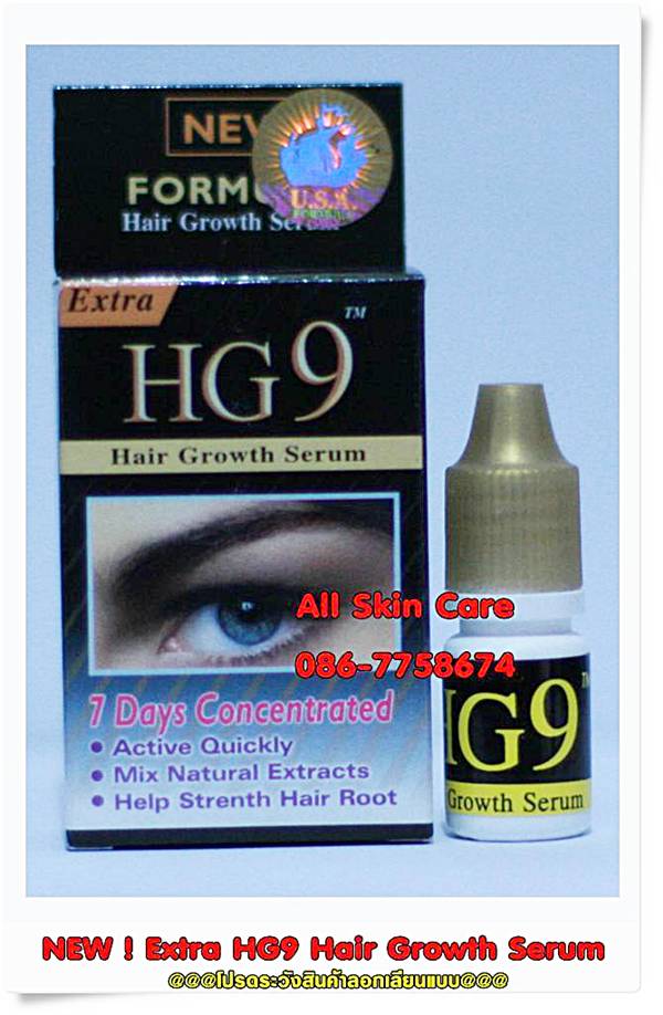 Emjoi Gently Gold Caress (Rechargeable)AP-9GAR  เครื่องถอนขนระบบมอตอร์ รุ่นชาร์แบตตอรี่แบบไร้สาย ของแท้ ทนทานนานคุ้มค่ะ รูปที่ 6