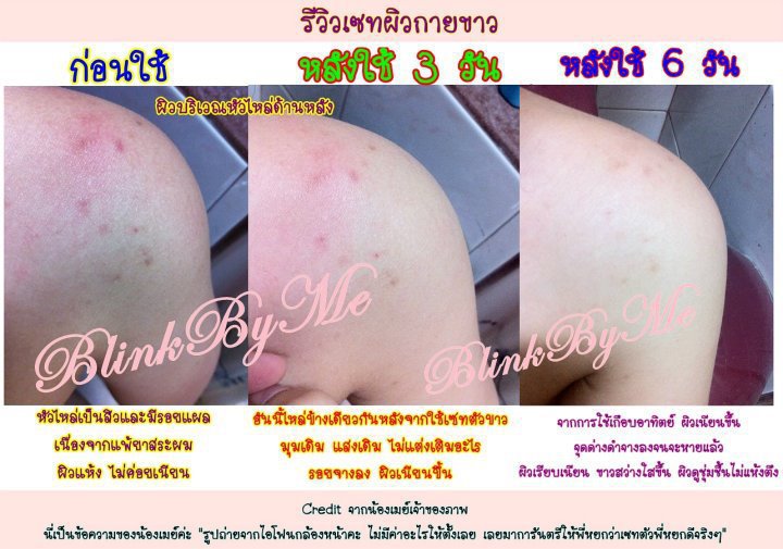 จำหน่ายครีมหน้าขาวใส เด้ง รูปที่ 3