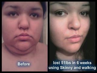 Skinny Body Care เพื่อสมดุลการย่อย รูปที่ 3