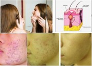 Kalos Scoria Soap - สบู่กาลอส  รูปที่ 3