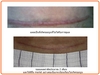 รูปย่อ Merlet Skintherapy serum ลดรอยแผลเป็นและแผลผ่าตัดอย่างได้ผลว่าไม่นูน รูปที่3