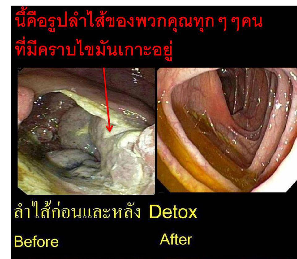 ไฮ คิว โปร รูปที่ 4