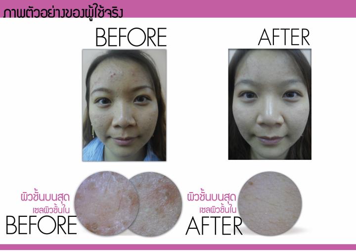 สบู่Kalos Scoria Soap - สบู่ล้างหน้า กาลอส  รูปที่ 7