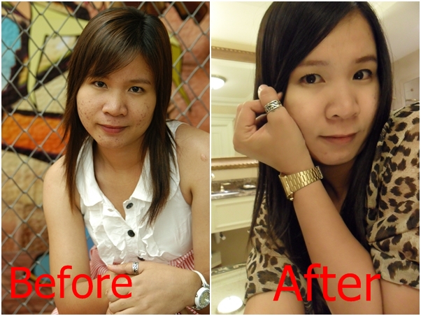 สบู่Kalos Scoria Soap - สบู่ล้างหน้า กาลอส  รูปที่ 5