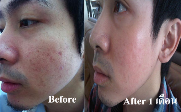 colly pink 6000 mg ราคาถูกมาก ขาว ใส เด้ง เร่งด่วน ภายใน 7 วัน รูปที่ 2