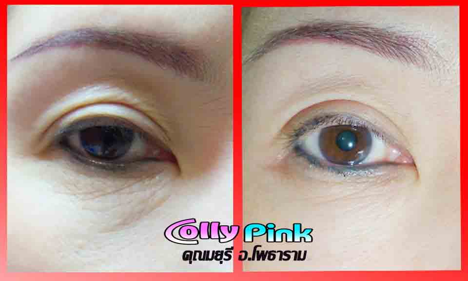 colly pink 6000 mg ราคาถูกมาก ขาว ใส เด้ง เร่งด่วน ภายใน 7 วัน รูปที่ 4