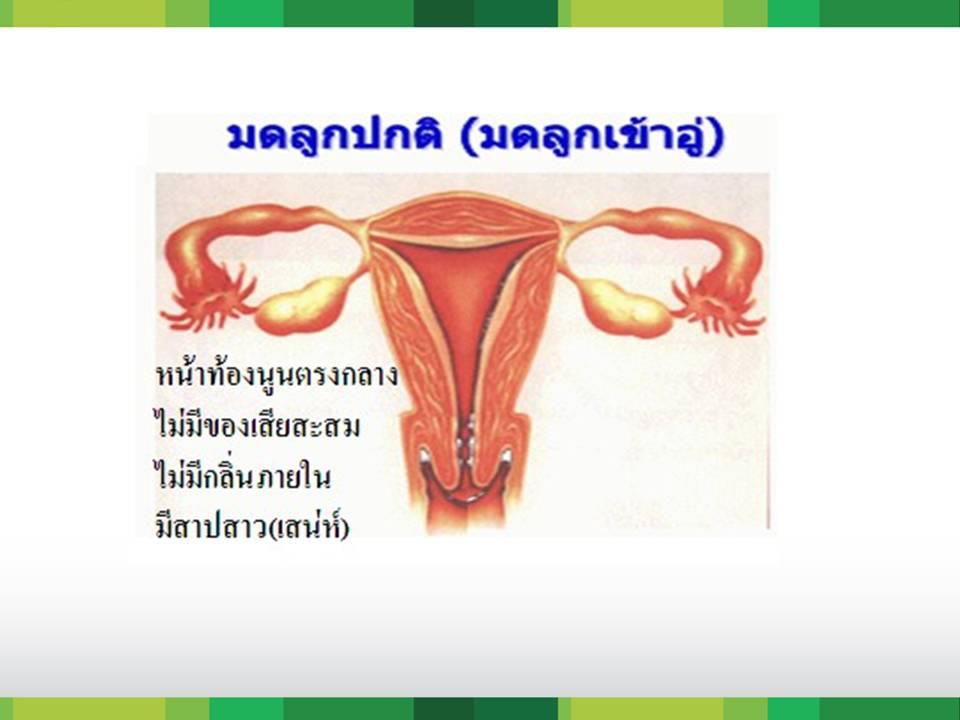 HYLI (ไฮลี่) - ผลิตภัณฑ์เสริมอาหาร สำหรับผู้หญิง รูปที่ 2