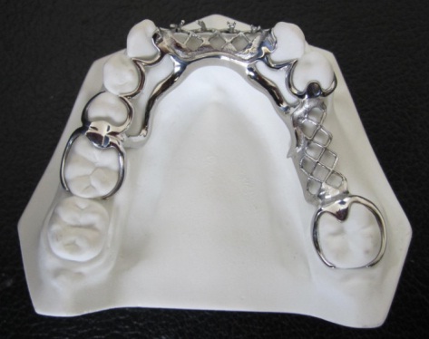 Dental Partial  Vitallium Framework - From Chinateeth รูปที่ 1