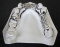Dental Partial  Vitallium Framework - From Chinateeth