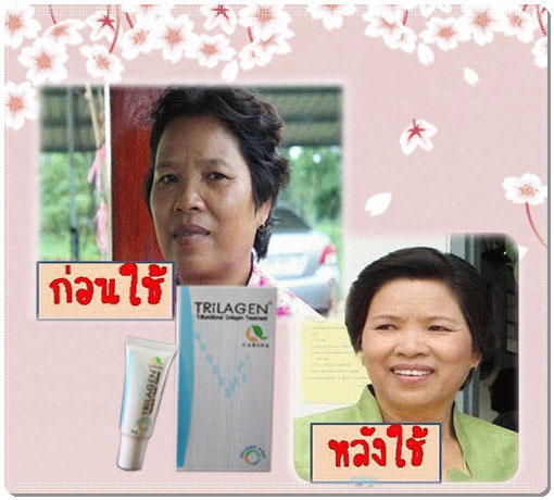 TRiLAGEN เน้นการสร้างคอลลาเจนถาวร ฟื้นฟูผิว ไร้ริ้วรอย เหี่ยวย่น  รูปที่ 4
