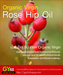 รูปย่อ Rose Hip Oil ช่วยกระตุ้นในผิวสร้างเนื้อเยื่อใหม่และชะลอผิวให้อ่อนวัย รูปที่3