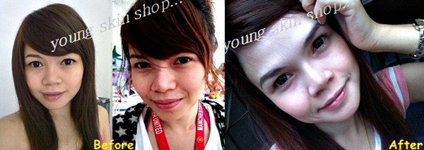 Cutie White Cream : ครีมหน้าขาว หน้าใส เอ๊าเลย !!! เว็บแรงของเมืองเลย รูปที่ 3