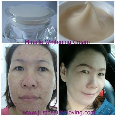 Miracle Whitening Cream ครีมหน้าใส ที่เน้นบำรุงและปรับสภาพสีผิวให้ขาวขึ้น ลดปัญหาสิว เร่งการผลัดเซลล์ ผิวไม่ระคายเคือง รูปที่ 1