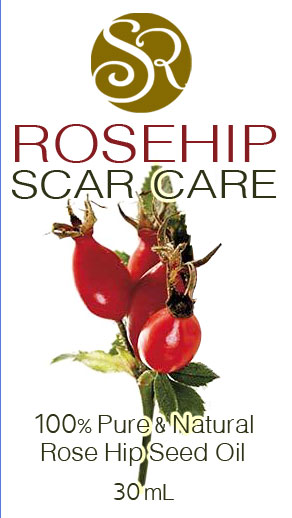 รอยสิว รอยแผลเป็น ยารักษารอยแผลเป็น รอยสิว ผิวแตกลาย หน้าท้องลาย ได้ผลดีที่สุดด้วยน้ำมันสกัด SR ROSEHIP SCAR CARE จากสหร รูปที่ 1