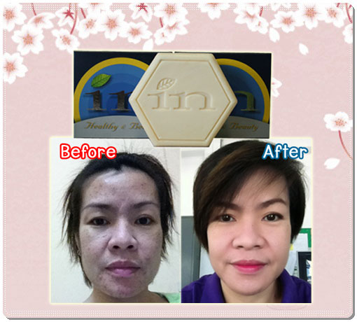 จำหน่าย สบู่อินนูต้า สบู่detox inootaล้างพิษ สบู่กระชับรูขุมขน เจลล้างหน้าทองคำ ผงมาร์คหน้าทองคำ  รูปที่ 2