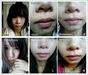 รูปย่อ Anti -Acne:เซตลดสิว กำจัดสิว ที่ดีที่สุด ถูกและดี รายระเอียดพร้อม รีวิว อ่าน>>>>> รูปที่4