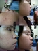 รูปย่อ Anti -Acne:เซตลดสิว กำจัดสิว ที่ดีที่สุด ถูกและดี รายระเอียดพร้อม รีวิว อ่าน>>>>> รูปที่3