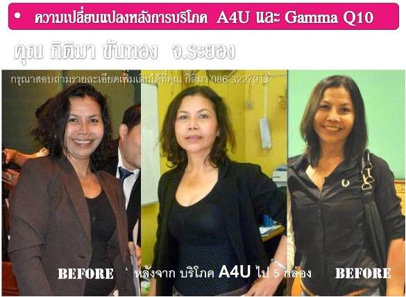 A4U ย้อนวัยสาว กระจ่างใส ลดต้นแขน ลดต้นขา ลดหน้าท้อง ซ่อมแซมทุกเซลล์ของร่างกายให้แข็งแรงดังเดิม รูปที่ 1