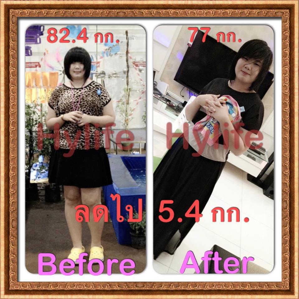 นวัตกรรมใหม่ ปลอดภัย ไม่ต้องอดอาหาร สาหร่ายช่วยลดสัดส่วน รูปที่ 2