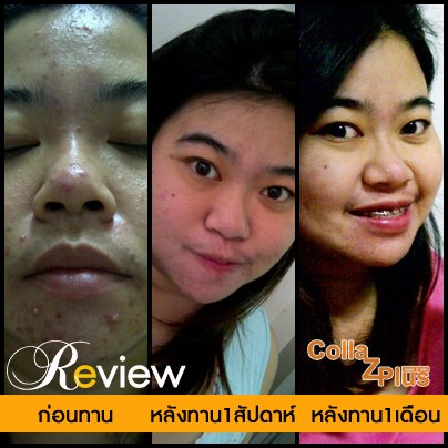 อยากผิวขาวใส ผิวเนียนนุ่ม คอลลา ซี พลัส Colla Z Plusเป็นคอลลาเจนคุณภาพสูงจากปลา