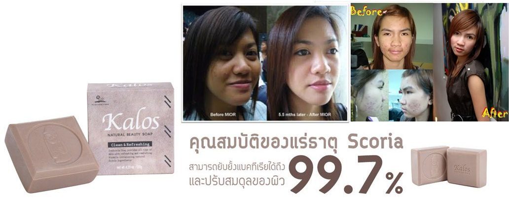 สบู่อีฟสโกเรีย รูปที่ 1