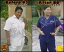 รูปย่อ ไลโปไลซิสทู Lypolysis II รูปที่3