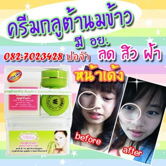 ครีมกลูต้าน้ำนมข้าว Winks (Set) สูตร Extra Skin  190 บาท. รูปที่ 1