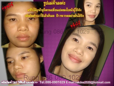 ครีมทาฝ้าครีมสมุนไพรหัวไชเท้าสมุนไพรแท้100% หน้าเนียนใส ลดสิว ลดฝ้า กระ จุดด่างดำ ใช้ดี มีอย. รูปที่ 7