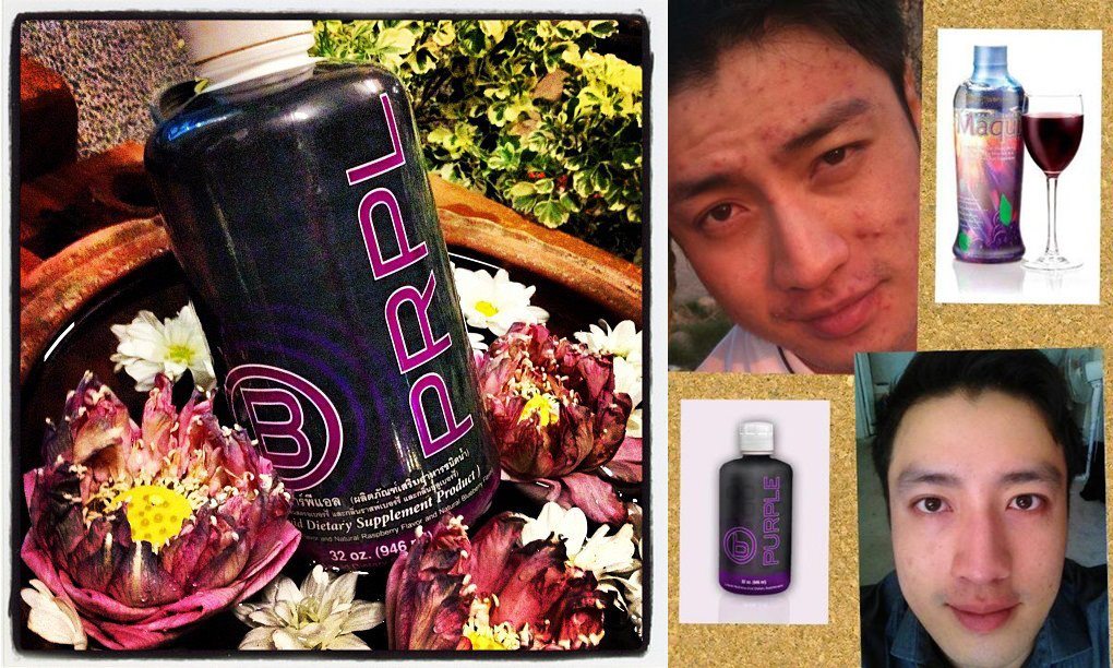  B-Prpl  รักษา โรคมะเร็ง โรคหัวใจ โรคเบาหวาน รูปที่ 5