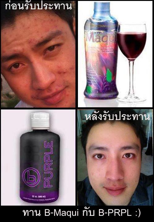  B-Prpl  รักษา โรคมะเร็ง โรคหัวใจ โรคเบาหวาน รูปที่ 3