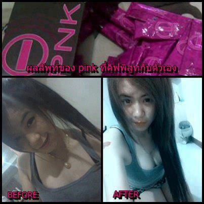  i-pnk  ลดสิว ผิวขาวใส ลดอาการปวดประจำเดือน หน้าอกใหญ่ขึ้น อก ฟู รู ฟิต รูปที่ 7