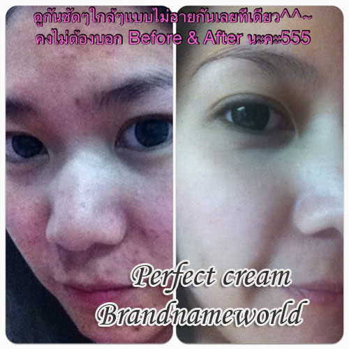 Perfect ครีม ครีมมหัศจรรย์ตัวดัง หน้าขาวเนียนใส ฝ้า กระ สิว รอยดำ หมองคล้ำหายไปจากชีวิต กระเป๋าแบรนด์ Lv...Hermes....Cha รูปที่ 4