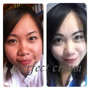 Perfect ครีม ครีมมหัศจรรย์ตัวดัง หน้าขาวเนียนใส ฝ้า กระ สิว รอยดำ หมองคล้ำหายไปจากชีวิต กระเป๋าแบรนด์ Lv...Hermes....Cha รูปที่ 6
