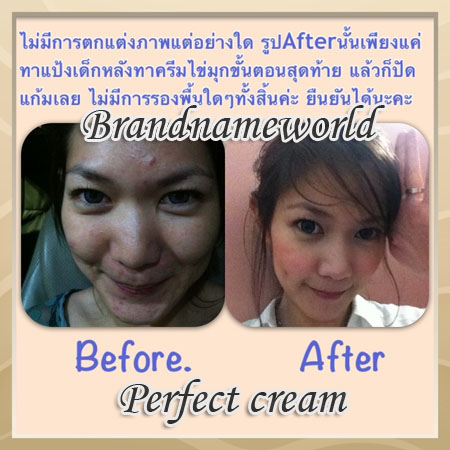 Perfect ครีม ครีมมหัศจรรย์ตัวดัง หน้าขาวเนียนใส ฝ้า กระ สิว รอยดำ หมองคล้ำหายไปจากชีวิต กระเป๋าแบรนด์ Lv...Hermes....Cha รูปที่ 5