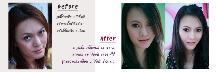 ชุดครีมหอยทากจากเกาหลี มี อย. ลดริ้วรอย ฝ้า กระ เห็นผลจริง ราคาเริ่มต้น 810 บาท จัดส่งฟรี!!! รูปที่ 3