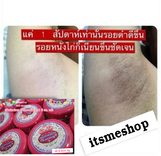 ครีมรักแร้ขาว & หัวนมชมพู 2in1 มีอย. 49 บาท รูปที่ 2