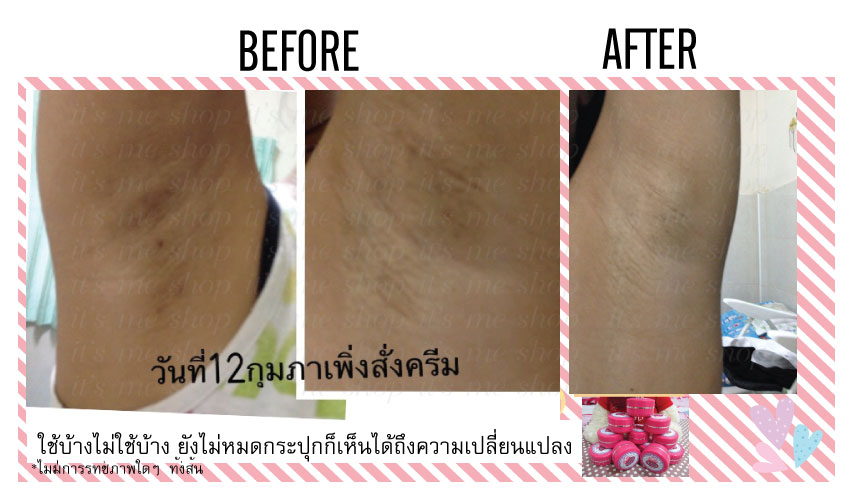 ครีมรักแร้ขาว & หัวนมชมพู 2in1 มีอย. 49 บาท รูปที่ 6