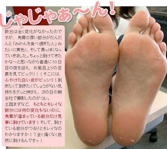 Japan --- แผ่นลอกเท้า มหัศจรรย์มิติใหม่ เท้าของคุณจะนุ่มและเหมือนเท้าเด็กกันเลยทีเดียวจ้า ราคา 190 บาท  รูปที่ 4