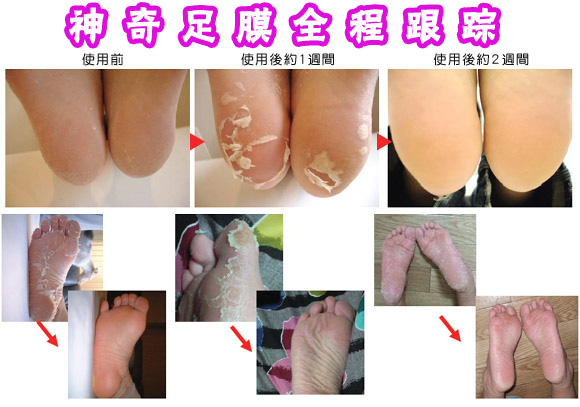 Japan --- แผ่นลอกเท้า มหัศจรรย์มิติใหม่ เท้าของคุณจะนุ่มและเหมือนเท้าเด็กกันเลยทีเดียวจ้า ราคา 190 บาท  รูปที่ 5