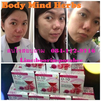 ดีเท็น พลัส d-10plus คอลลาเจน 6000 mg ราคาถูกที่สุด,ปลีก,ส่ง,สมาชิก,รับสมัครตัวแทนจำหน่าย,เปิดหาร รูปที่ 1