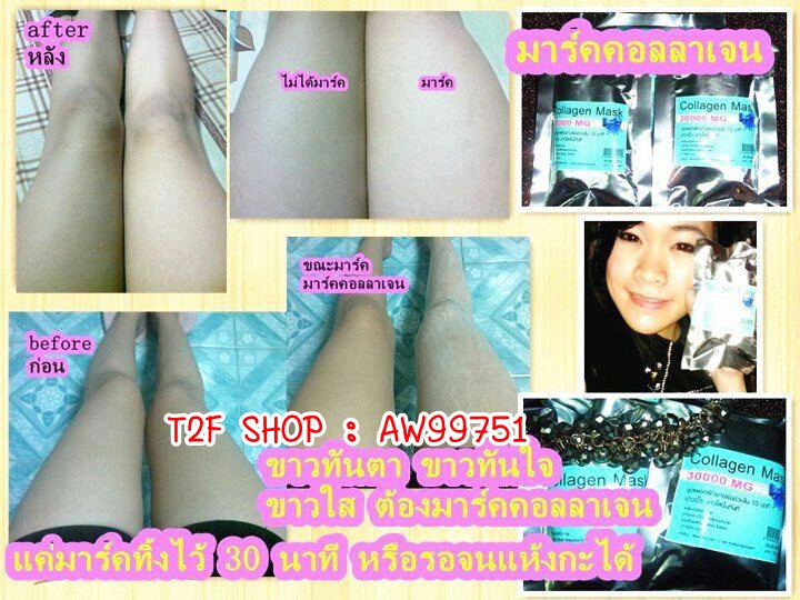 พอกผิวตัวใหม่ คอลลาเจนมาร์กผิว เห็นผลจริงตั้งแต่ครั้งแรก ผลลัพท์ที่ได้ ผิวที่คล้ำสะสมจากการตากแดดมาเป็นเวลานาน ขาวขึ้น เนียนขึ้น ใสขึ้น ไม่หยาบกระด้างแล รูปที่ 6