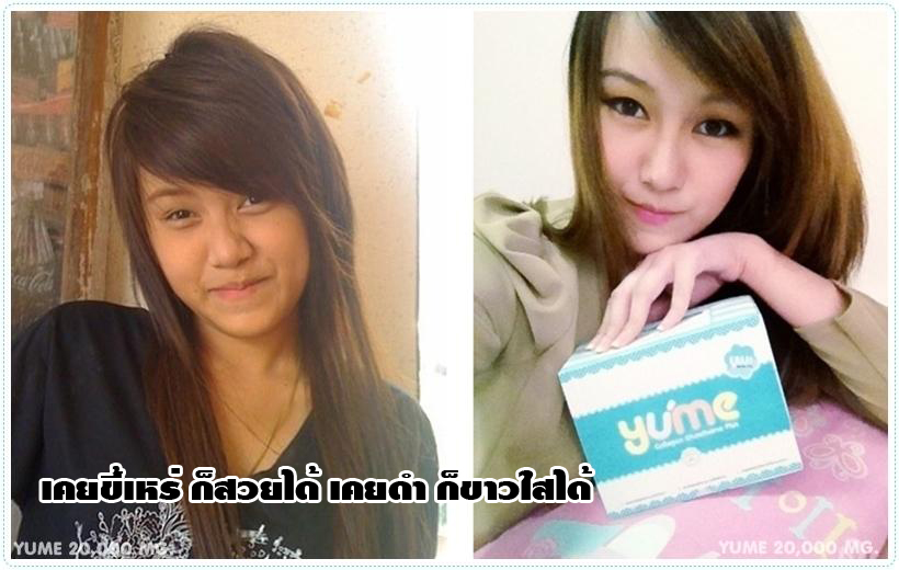 ลืมไปเลย ว่าเคยดำ..!! ให้ยูเมะคอลลาเจนช่วยคุณสิคะ รูปที่ 7